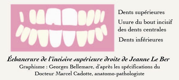 dentition de Jeanne Le Ber