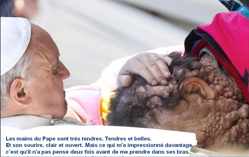 Le Pape François embrasse une personne défigurée